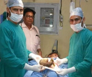 baby opration, doctor shocked
