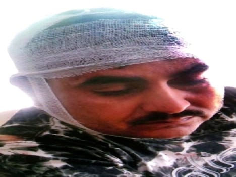 Beaten with rifle Bton fertilizer salesman