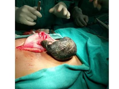 Doctors did a tough operation of a teenaged girl.