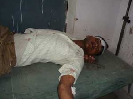 Three people injured in the two sides fight