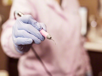 women who superglued her teeth for ten long years