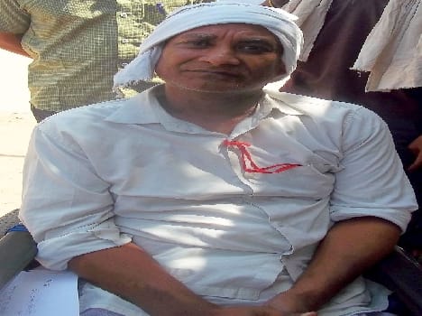 Disability compensation is wandering the Kaushlendra