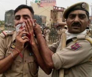 sub inspector injured in bhinderwala row is stable now