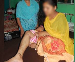 brutality with daughter in law by in laws