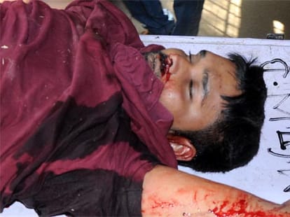 encounter story of rahul khatta