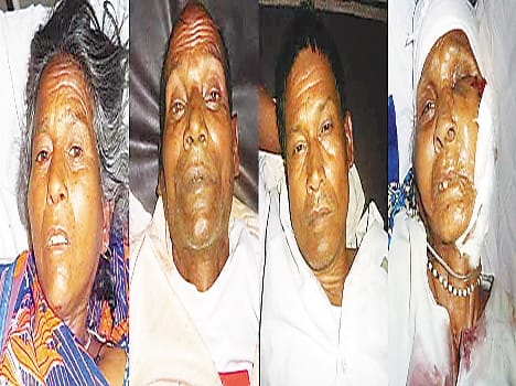 11 people injured in road accidents