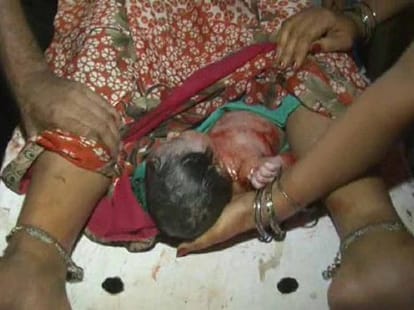 Due to the negligence of the hospital gave birth to a girl in the e-rickshaw.