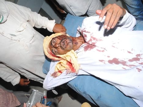 five injoured in firing