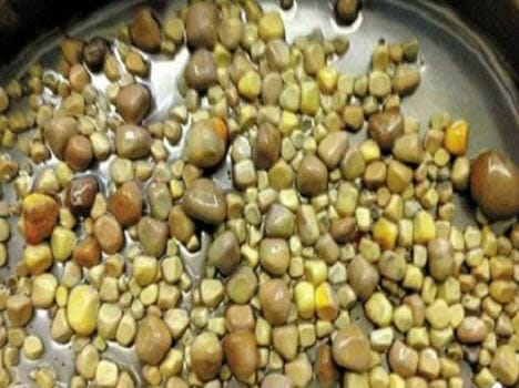stone kidney operation in china 420 stones