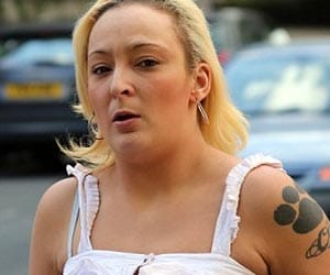drunken woman bit off a part of man's lip in bar