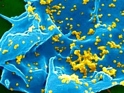 Coronavirus infections