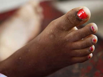 head cutted dead body ogf girl is found