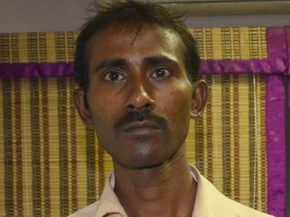 Doctor forget to remove drain pipe after surgery