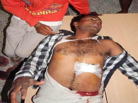 Son Srebajar Stabbed