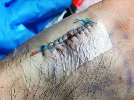 russian engineer implanted card in his hand