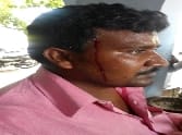 The bus conductors Contracts Driver's head boil