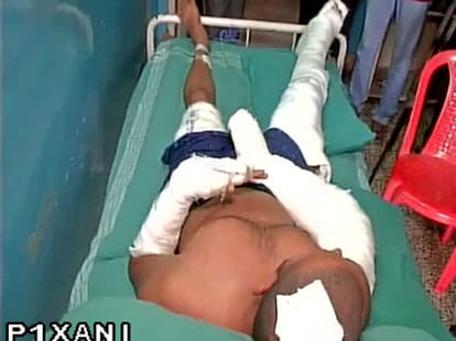 Drug mafia Brutally attacked on Kerala activist working against him.