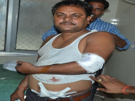 The bike rider injured tiger attack