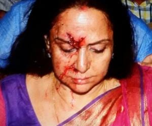 hema injured in an accident in rajsthan