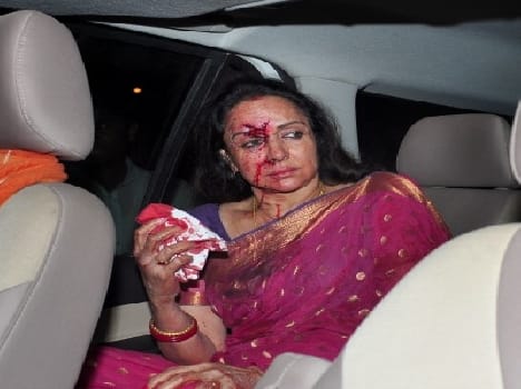 hema injured in an accident in mathura