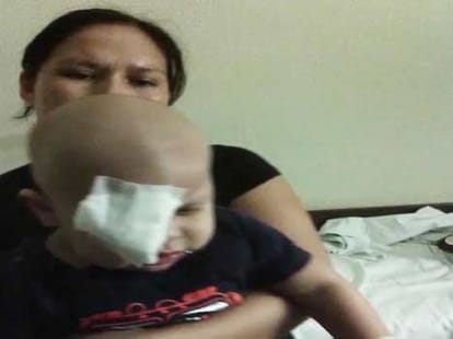 surgeon removed the wrong eye of a one year kid