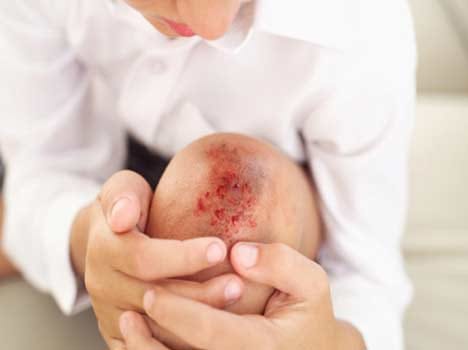 elastic gels will soon fill the wounds