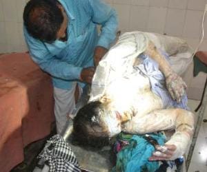 video of barabanki burn woman before death