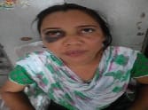 Female teacher husband The brutally beaten