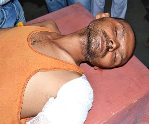 bike skid, four injured