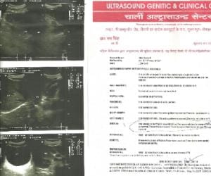 Uterus is found in a man stomach