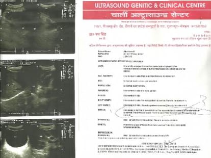 Uterus is found in a man stomach