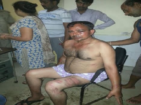 clash between firebrigrade sepoy in mathura