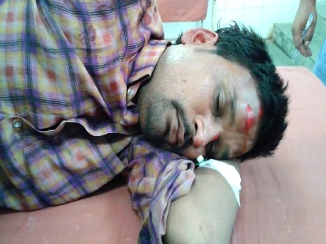 Sprung from police jeep Htyaropi critically injured