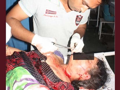 in oneside love man cuts the neck of girl and her mother in bijnor