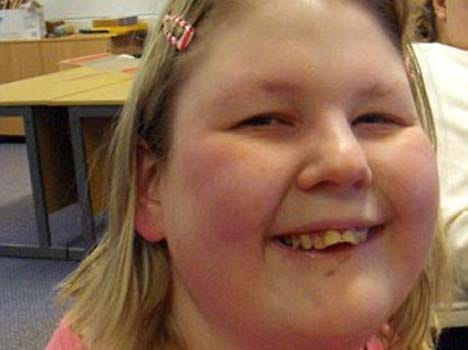 fat girl died due to high cravings for food