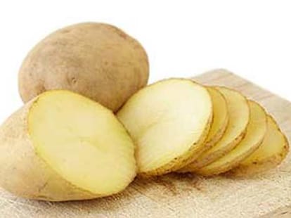 home remdies to remove ugly stretch marks