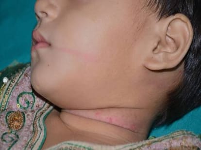 man strangled his own daughters.