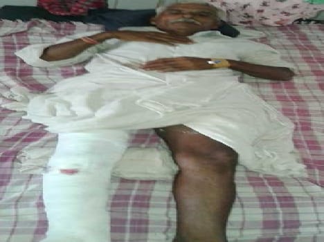 The doctor's negligence , the patient is suffering