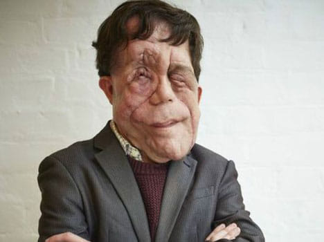 why do people hate disabled people