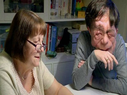 why do people hate disabled people