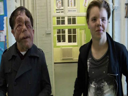 why do people hate disabled people