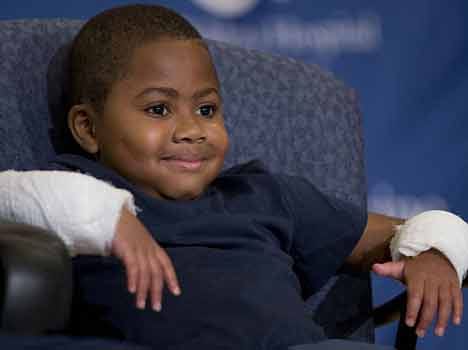 The boy with a DOUBLE hand transplant: Zion, eight, shows off new limbs after he lost both hands to infection when he was two