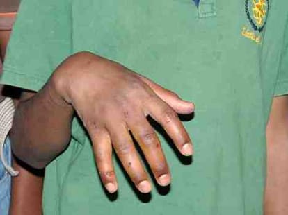 Children when refuse to work their nails were tore from plass
