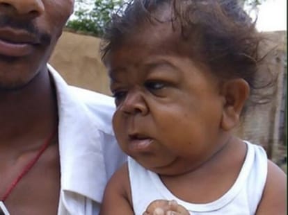 unique child of 19 years old in haryana