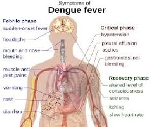 Two workers from Delhi dengue