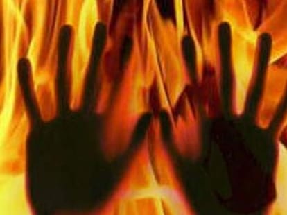 Woman set ablaze by in-laws kullu himachal