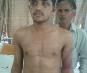fraud police beaten cruely a boy