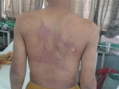 fraud police beaten cruely a boy