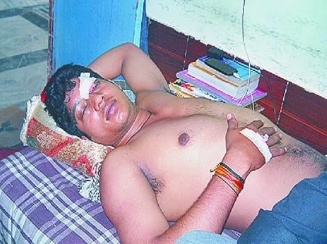 choron ne chhattra ko pita