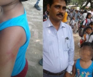 Teacher beated nursery class student
